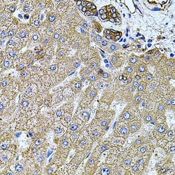 Invitrogen Filamin B Polyclonal Antibody 100 &mu;L; Unconjugated:Antibodies,
