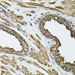 Invitrogen Filamin B Polyclonal Antibody 100 &mu;L; Unconjugated:Antibodies,