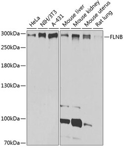 Invitrogen Filamin B Polyclonal Antibody 100 &mu;L; Unconjugated:Antibodies,