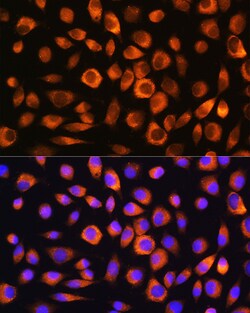 HSC70 Polyclonal Antibody:Antibodies, Polyclonal