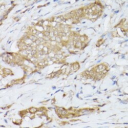 HSC70 Polyclonal Antibody:Antibodies, Polyclonal