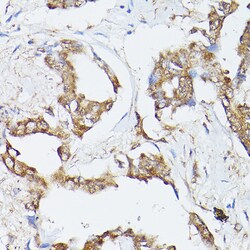 HSC70 Polyclonal Antibody:Antibodies, Polyclonal