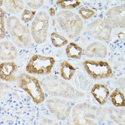HSC70 Polyclonal Antibody:Antibodies, Polyclonal