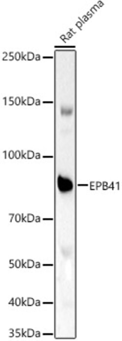 Invitrogen EPB41 Polyclonal Antibody 100 &mu;L; Unconjugated:Antibodies,