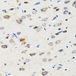 Invitrogen SIAH1 Polyclonal Antibody 100 &mu;L | Buy Online | Invitrogen&trade; | Fisher Scientific