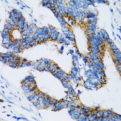 Invitrogen SIAH1 Polyclonal Antibody 100 &mu;L | Buy Online | Invitrogen&trade; | Fisher Scientific