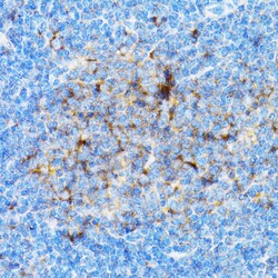 Invitrogen SIAH1 Polyclonal Antibody 100 &mu;L | Buy Online | Invitrogen&trade; | Fisher Scientific