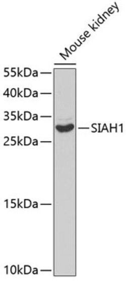 Invitrogen SIAH1 Polyclonal Antibody 100 &mu;L | Buy Online | Invitrogen&trade; | Fisher Scientific