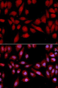 Invitrogen PSMA2 Polyclonal Antibody 100 &mu;L; Unconjugated:Antibodies,