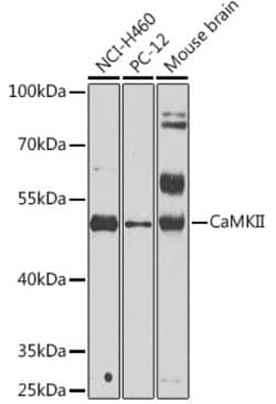 Invitrogen CaMKII beta Polyclonal Antibody 100 &mu;L | Buy Online | Invitrogen&trade; | Fisher Scientific