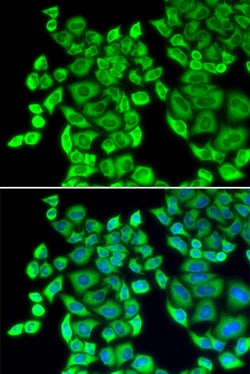 Invitrogen EEF1D Polyclonal Antibody 100 &mu;L; Unconjugated:Antibodies,