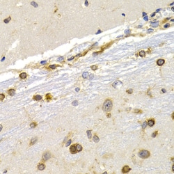 Invitrogen EEF1D Polyclonal Antibody 100 &mu;L; Unconjugated:Antibodies,