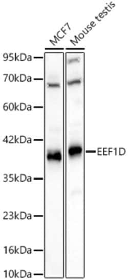 Invitrogen EEF1D Polyclonal Antibody 100 &mu;L; Unconjugated:Antibodies,
