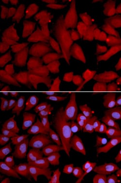 Invitrogen PSMA4 Polyclonal Antibody 100 &mu;L; Unconjugated:Antibodies,