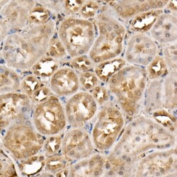Invitrogen ACK1 Polyclonal Antibody 100 &mu;L; Unconjugated:Antibodies,