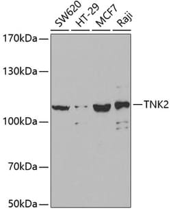 Invitrogen ACK1 Polyclonal Antibody 100 &mu;L; Unconjugated:Antibodies,