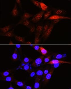 PLK1 Polyclonal Antibody, Invitrogen 100 &mu;L; Unconjugated:Antibodies,