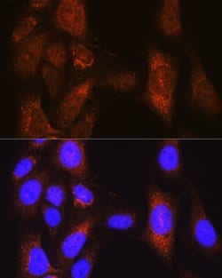 PLK1 Polyclonal Antibody, Invitrogen 100 &mu;L; Unconjugated:Antibodies,