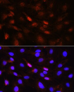 PLK1 Polyclonal Antibody, Invitrogen 100 &mu;L; Unconjugated:Antibodies,