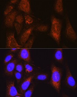 PLK1 Polyclonal Antibody, Invitrogen 100 &mu;L; Unconjugated:Antibodies,