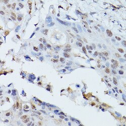 PLK1 Polyclonal Antibody, Invitrogen 100 &mu;L; Unconjugated:Antibodies,