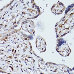 PLK1 Polyclonal Antibody, Invitrogen 100 &mu;L; Unconjugated:Antibodies,