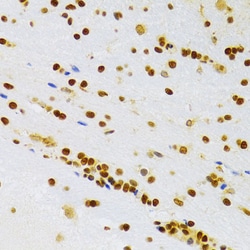 Invitrogen HMGB1 Polyclonal Antibody 100 &mu;L; Unconjugated:Antibodies,