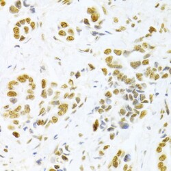 Invitrogen HMGB1 Polyclonal Antibody 100 &mu;L; Unconjugated:Antibodies,
