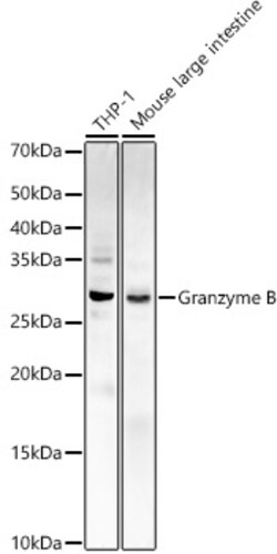 Invitrogen Granzyme B Polyclonal Antibody 100 &mu;L | Buy Online | Invitrogen&trade; | Fisher Scientific