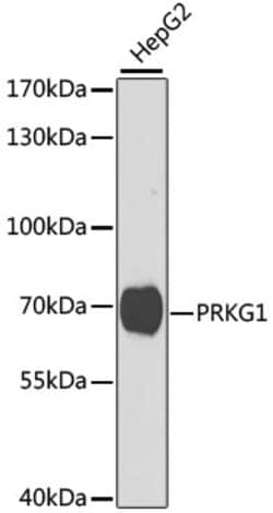 Invitrogen cGKI Polyclonal Antibody 100 &mu;L; Unconjugated:Antibodies,