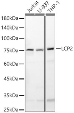 Invitrogen SLP76 Polyclonal Antibody 100 &mu;L; Unconjugated:Antibodies,