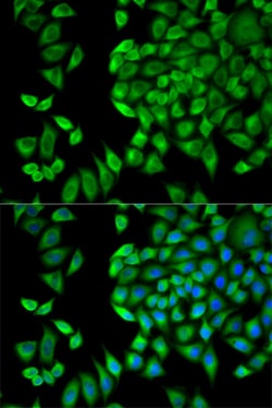 Invitrogen WNK1 Polyclonal Antibody 100 &mu;L; Unconjugated:Antibodies,