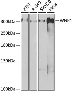 Invitrogen WNK1 Polyclonal Antibody 100 &mu;L; Unconjugated:Antibodies,