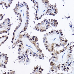 Invitrogen PDCD4 Polyclonal Antibody 100 &mu;L; Unconjugated:Antibodies,