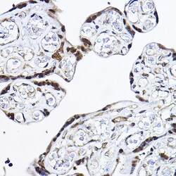 Invitrogen PDCD4 Polyclonal Antibody 100 &mu;L; Unconjugated:Antibodies,