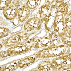 Invitrogen TBK1 Polyclonal Antibody 100 &mu;L; Unconjugated:Antibodies,