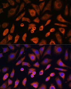 Invitrogen N-WASP Polyclonal Antibody 100 &mu;L | Buy Online | Invitrogen&trade; | Fisher Scientific