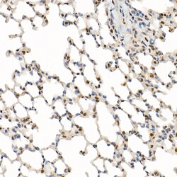 Invitrogen N-WASP Polyclonal Antibody 100 &mu;L | Buy Online | Invitrogen&trade; | Fisher Scientific
