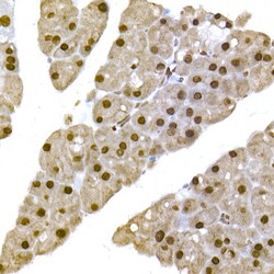 Invitrogen N-WASP Polyclonal Antibody 100 &mu;L | Buy Online | Invitrogen&trade; | Fisher Scientific