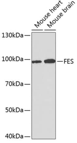Invitrogen FES Polyclonal Antibody 100 &mu;L; Unconjugated:Antibodies,