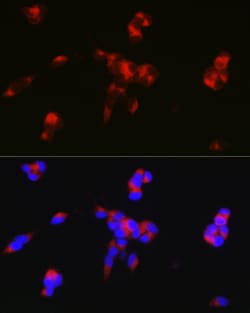 DARPP-32 Polyclonal Antibody:Antibodies, Polyclonal
