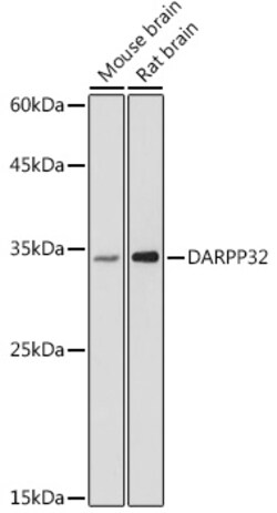 DARPP-32 Polyclonal Antibody:Antibodies, Polyclonal