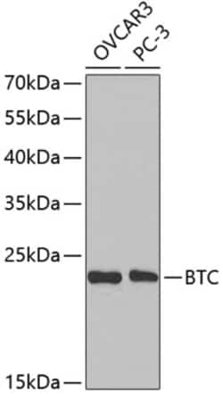 Invitrogen betacellulin Polyclonal Antibody 100 &mu;L | Buy Online | Invitrogen&trade; | Fisher Scientific