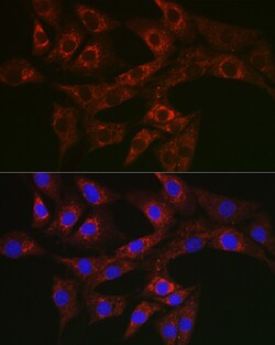 Invitrogen ATG4A Polyclonal Antibody 100 &mu;L; Unconjugated:Antibodies,