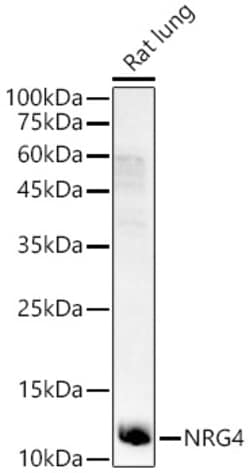 Invitrogen NRG4 Polyclonal Antibody 100 &mu;L; Unconjugated:Anticuerpos