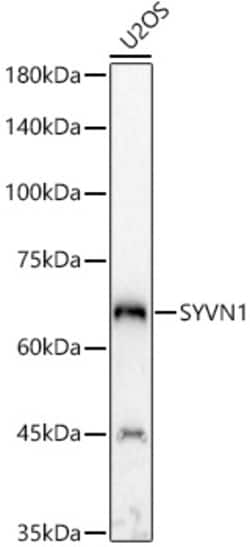 Invitrogen HRD1 Polyclonal Antibody 100 &mu;L; Unconjugated:Antibodies,