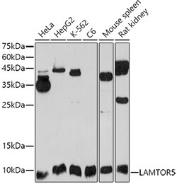 Invitrogen LAMTOR5 Polyclonal Antibody 100 &mu;L; Unconjugated:Antibodies,