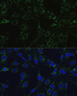 Invitrogen COX5B Polyclonal Antibody 100 &mu;L; Unconjugated:Antibodies,