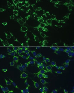 Invitrogen COX5B Polyclonal Antibody 100 &mu;L; Unconjugated:Antibodies,