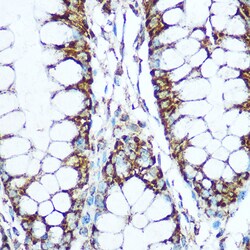 Invitrogen COX5B Polyclonal Antibody 100 &mu;L; Unconjugated:Antibodies,